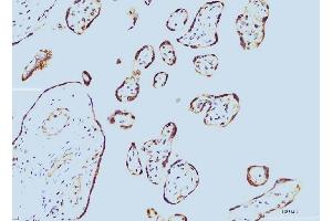 IHC analysis of Cyclophilin E/PPIE using anti-Cyclophilin E/PPIE antibody (ABIN7599243). (PPIE Antikörper  (AA 1-301))