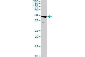 C17orf75 monoclonal antibody (M02), clone 2D7. (C17orf75 Antikörper  (AA 1-100))