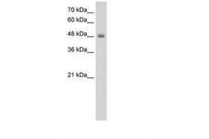 Image no. 1 for anti-Ring Finger Protein 128 (RNF128) (C-Term) antibody (ABIN203522) (RNF128 Antikörper  (C-Term))