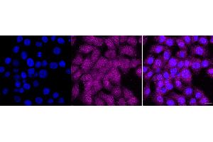 anti-Phospholipid Transfer Protein (PLTP) antibody