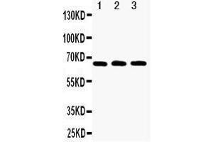 Western Blotting (WB) image for anti-Tumor Necrosis Factor Receptor Superfamily, Member 11a, NFKB Activator (TNFRSF11A) (AA 29-44), (N-Term) antibody (ABIN3042604)