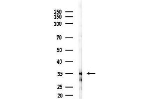 Western blot analysis of lysates from EC304 cells(starvation 24h treatment), using MORF4L1 Antibody at 1/1000 dilution.