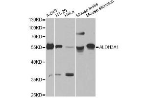 Western blot analysis of extracts of various cell lines, using ALDH3A1 antibody.