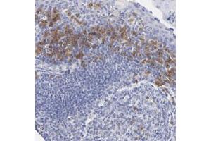 Immunohistochemical staining of human tonsil with LAX1 polyclonal antibody  shows cytoplasmic positivity in lymphoid cells outside reaction centra at 1:50-1:200 dilution. (LAX1 Antikörper)