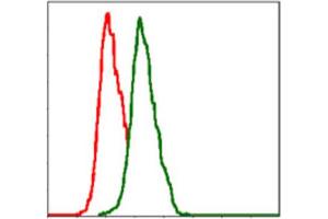 Immunohistochemical analysis of paraffin-embedded cervical cancer tissues using ITGB1 antibody with DAB staining. (ITGB1 Antikörper)