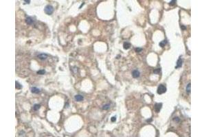 Immunohistochemical analysis of paraffin-embedded human fetal liver showing cytoplasmic staining with HINT2 polyclonal antibody  at a 1 : 100 dilution. (HINT2 Antikörper  (AA 59-163))