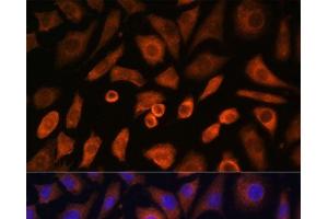 Immunofluorescence analysis of L-929 cells using N-WASP Polyclonal Antibody at dilution of 1:100 (40x lens). (Neural Wiskott-Aldrich syndrome protein (WASL) Antikörper)