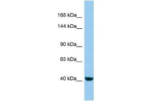 Western Blotting (WB) image for anti-KN Motif and Ankyrin Repeat Domains 4 (KANK4) (C-Term) antibody (ABIN2790793) (KANK4 Antikörper  (C-Term))