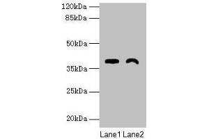 Western blot All lanes: TMEM255A antibody at 6 μg/mL Lane 1: Mouse stomach tissue Lane 2: Mouse heart tissue Secondary Goat polyclonal to rabbit IgG at 1/10000 dilution Predicted band size: 39, 21, 36, 27 kDa Observed band size: 39 kDa (FAM70A Antikörper  (AA 110-225))