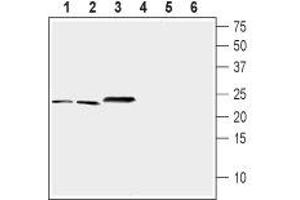 Western blot analysis of mouse brain (lanes 1 and 4), rat brain (lanes 2 and 5) and rat eye (lanes 3 and 6) lysates (1:200-1:400): - 1-3. (NCS1 Antikörper  (Intracellular))
