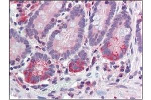 Immunohistochemistry (IHC) image for anti-Tyrosyl-DNA Phosphodiesterase 1 (TDP1) (AA 1-298), (N-Term) antibody (ABIN400859) (TDP1 Antikörper  (N-Term))