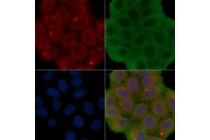 ABIN6260877 and ABIN6277178 staining Hela cells(30 min of UV treatment) by IF/ICC. (Claudin 1 Antikörper  (C-Term))