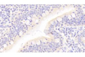 Detection of REG3a in Human Small intestine Tissue using Polyclonal Antibody to Regenerating Islet Derived Protein 3 Alpha (REG3a) (REG3A Antikörper  (AA 40-164))