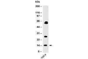 Western blot testing of human samples using SUMO1 antibody (SM1/495). (SUMO1 Antikörper)