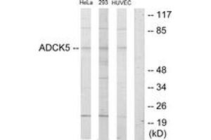 Western Blotting (WB) image for anti-AarF Domain Containing Kinase 5 (ADCK5) (AA 151-200) antibody (ABIN2889630) (ADCK5 Antikörper  (AA 151-200))