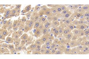 Detection of MCSFR in Mouse Liver Tissue using Polyclonal Antibody to Colony Stimulating Factor Receptor, Macrophage (MCSFR) (CSF1R Antikörper  (AA 639-868))