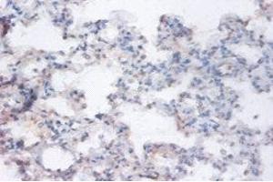 Immunohistochemistry of paraffin-embedded human lung tissue using ABIN7167205 at dilution of 1:100 (RRAGA Antikörper  (AA 1-247))