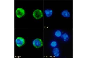 Immunofluorescence staining of fixed Human peripheral blood leukocytes with anti-MARCO antibody PLK1. (Rekombinanter MARCO Antikörper)