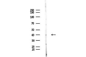 anti-Actin, beta-Like 2 (ACTBL2) (Internal Region) antibody