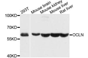 Western blot analysis of extracts of various cell lines, using OCLN antibody. (Occludin Antikörper  (AA 263-522))