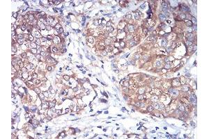 Immunohistochemistry (IHC) image for anti-RAB1B, Member RAS Oncogene Family (RAB1B) (AA 60-201) antibody (ABIN5542373)