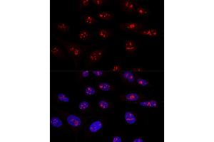 Confocal immunofluorescence analysis of U2OS cells using NOP58 Polyclonal Antibody  at dilution of 1:100. (NOP58 Antikörper  (AA 360-529))
