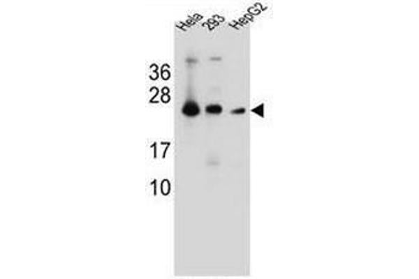 MESDC2 Antikörper  (C-Term)