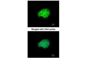 ICC/IF Image Immunofluorescence analysis of paraformaldehyde-fixed A431, using HSPA6, antibody at 1:200 dilution. (HSPA6 Antikörper  (Center))