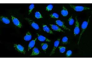 IF analysis of DLGAP1 using anti-DLGAP1 antibody (ABIN7600257).