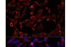 Immunofluorescence analysis of NIH/3T3 cells using UCP3 Polyclonal Antibody at dilution of 1:100. (UCP3 Antikörper)