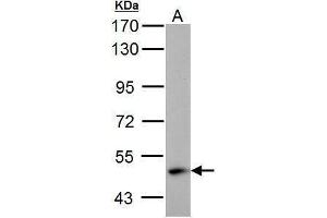 Western Blotting (WB) image for anti-4-Aminobutyrate Aminotransferase (ABAT) antibody (ABIN2854765)