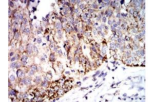 Immunohistochemistry (IHC) image for anti-Superoxide Dismutase 2, Mitochondrial (SOD2) (AA 1-222) antibody (ABIN5888812) (SOD2 Antikörper  (AA 1-222))