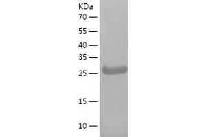 Western Blotting (WB) image for phospholipid Scramblase 1 (PLSCR1) (AA 1-288) protein (His tag) (ABIN7124434)