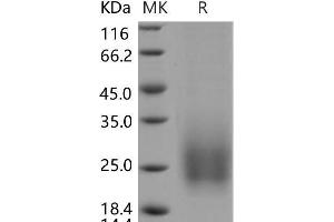 Tetraspanin 7 Protein (TSPAN7) (His tag)