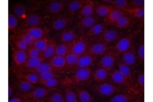 Immunofluorescence staining of methanol-fixed MCF cells using VEGFR2(Phospho-Tyr1214) Antibody. (VEGFR2/CD309 Antikörper  (pTyr1214))