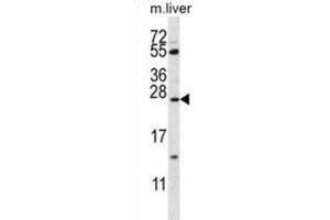 Western Blotting (WB) image for anti-Surfactant Protein C (SFTPC) antibody (ABIN2911136) (Surfactant Protein C Antikörper)