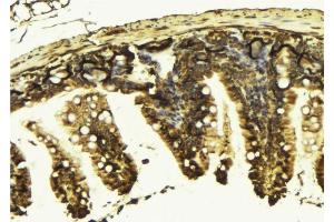ABIN6277591 at 1/100 staining Mouse colon tissue by IHC-P.