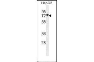 Western blot analysis of LRRC40 Antibody (C-term) in HepG2 cell line lysates (35ug/lane). (LRRC40 Antikörper  (C-Term))