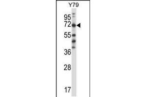 Western blot analysis in Y79 cell line lysates (35ug/lane). (FARSB Antikörper  (C-Term))
