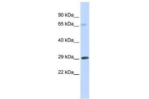 FCER1A antibody used at 1 ug/ml to detect target protein. (Fc epsilon RI/FCER1A Antikörper  (Middle Region))