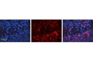 Rabbit Anti-E2F1 Antibody Catalog Number: ARP31171_P050 Formalin Fixed Paraffin Embedded Tissue: Human Lymph Node Tissue Observed Staining: Cytoplasm Primary Antibody Concentration: 1:100 Other Working Concentrations: 1:600 Secondary Antibody: Donkey anti-Rabbit-Cy3 Secondary Antibody Concentration: 1:200 Magnification: 20X Exposure Time: 0. (E2F1 Antikörper  (Middle Region))