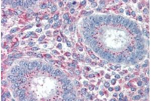 Human Uterus (formalin-fixed, paraffin-embedded) stained with PRRX1 antibody ABIN337108 at 5 ug/ml followed by biotinylated anti-goat IgG secondary antibody ABIN481715, alkaline phosphatase-streptavidin and chromogen. (PRRX1 Antikörper  (AA 73-83))