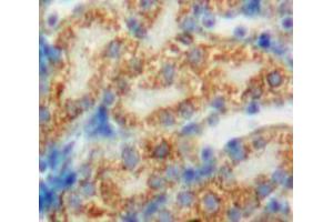 Used in DAB staining on fromalin fixed paraffin-embedded Kidney tissue (PDP Antikörper  (AA 315-537))