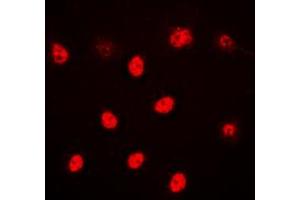Immunofluorescent analysis of ALX3 staining in HeLa cells.