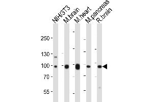 Western blot analysis of lysates from mouse NIH/3T3 cell line, mouse brain, mouse heart, mouse pancreas, rat brain tissue lysate (from left to right), using Ephb1 Antibody (Center) (ABIN6243651 and ABIN6577667). (EPH Receptor B1 Antikörper  (AA 304-339))