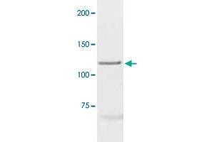 The cell lysate derived from MCF-7 was immunoprobed by PGR polyclonal antibody  at 1 : 500.