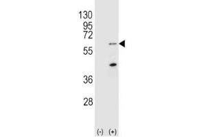 Western blot analysis of PINK1 antibody and 293 cell lysate (2 ug/lane) either nontransfected (Lane 1) or transiently transfected (2) with the Park6/PINK1 gene.