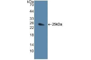 Detection of Recombinant JAG1, Human using Polyclonal Antibody to Jagged 1 (JAG1) (JAG1 Antikörper  (AA 836-1047))