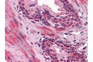 Immunohistochemical analysis of paraffin-embedded human Prostate tissues using LCN1 mouse mAb (Lipocalin 1 Antikörper)