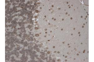 IHC analysis of TrpM7 tested on mouse brain using a dilution of TRPM7 antibody. (TRPM7 Antikörper  (AA 1817-1863) (PE))